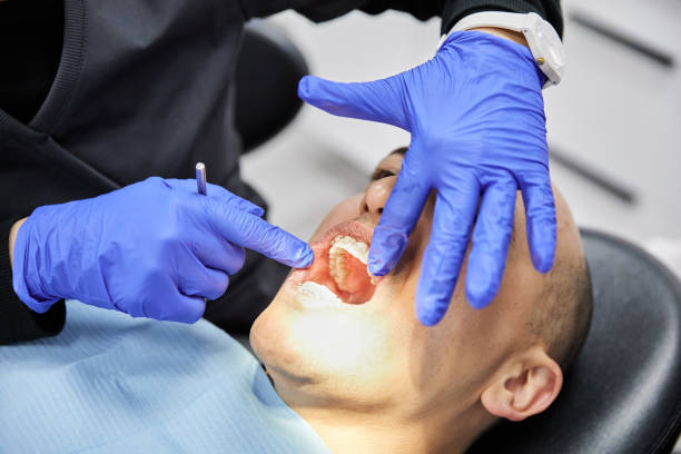 Best Emergency Treatment for Toothache in Tonawanda, NY